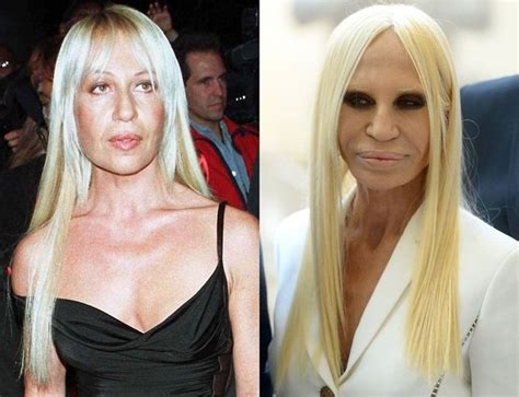 donatella versace antes